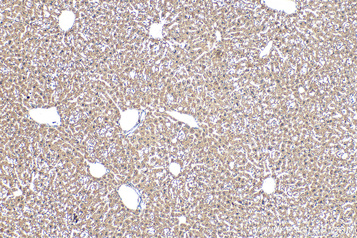 Immunohistochemistry (IHC) staining of mouse liver tissue using CISD3 Polyclonal antibody (30480-1-AP)