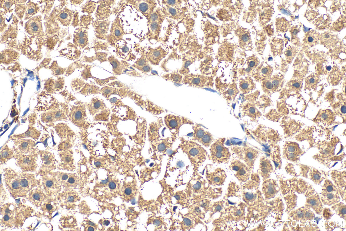 Immunohistochemistry (IHC) staining of mouse liver tissue using CISD3 Polyclonal antibody (30480-1-AP)