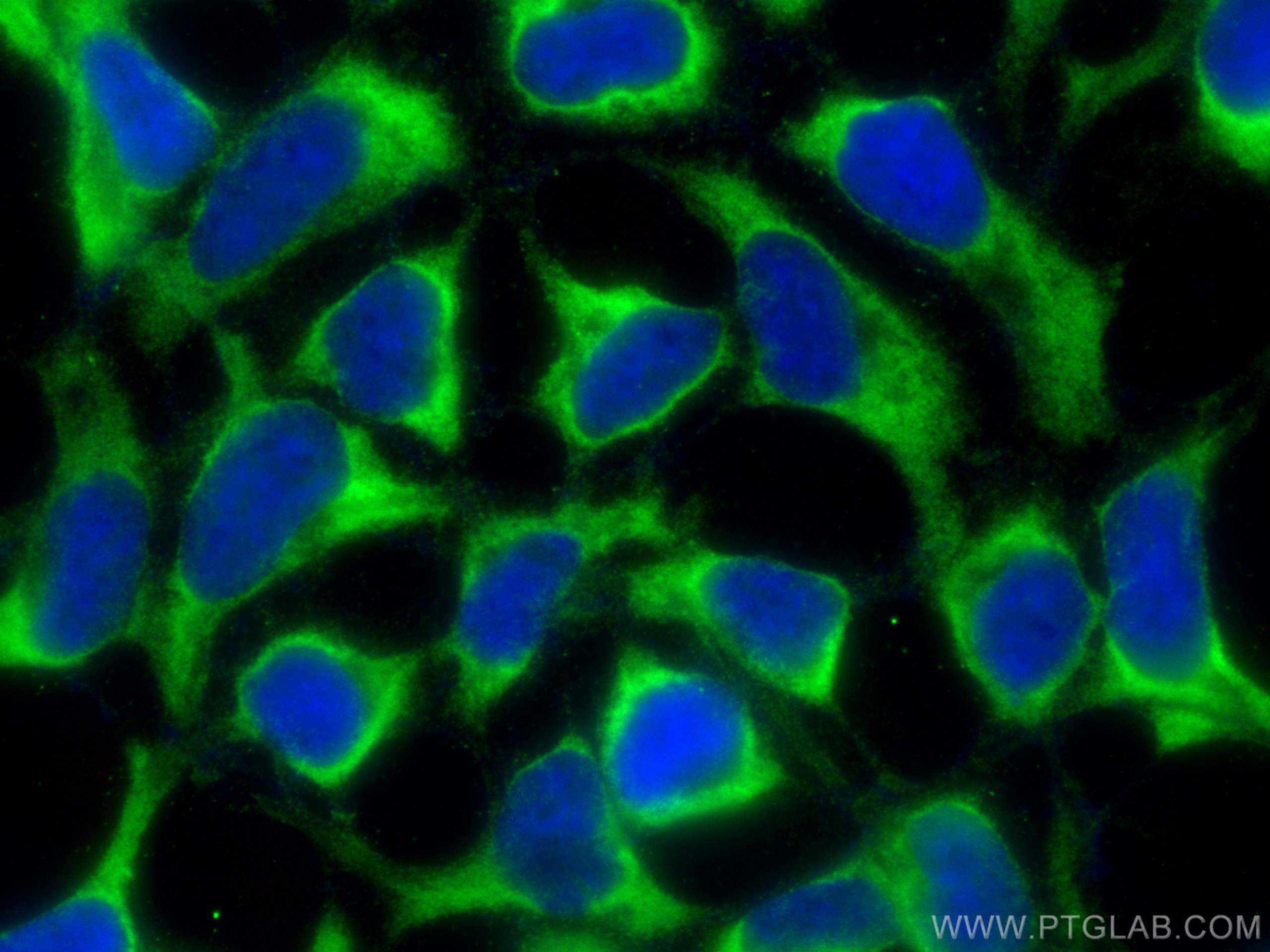 Immunofluorescence (IF) / fluorescent staining of HEK-293 cells using CITED1 Polyclonal antibody (26999-1-AP)