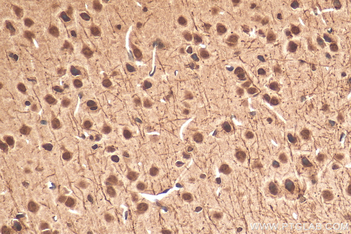 Immunohistochemistry (IHC) staining of mouse brain tissue using CITED2 Polyclonal antibody (15021-1-AP)