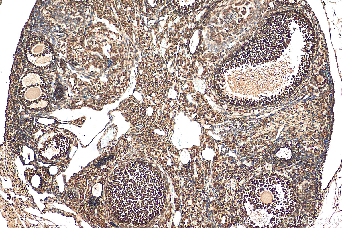 Immunohistochemistry (IHC) staining of mouse ovary tissue using CITED2 Polyclonal antibody (15021-1-AP)