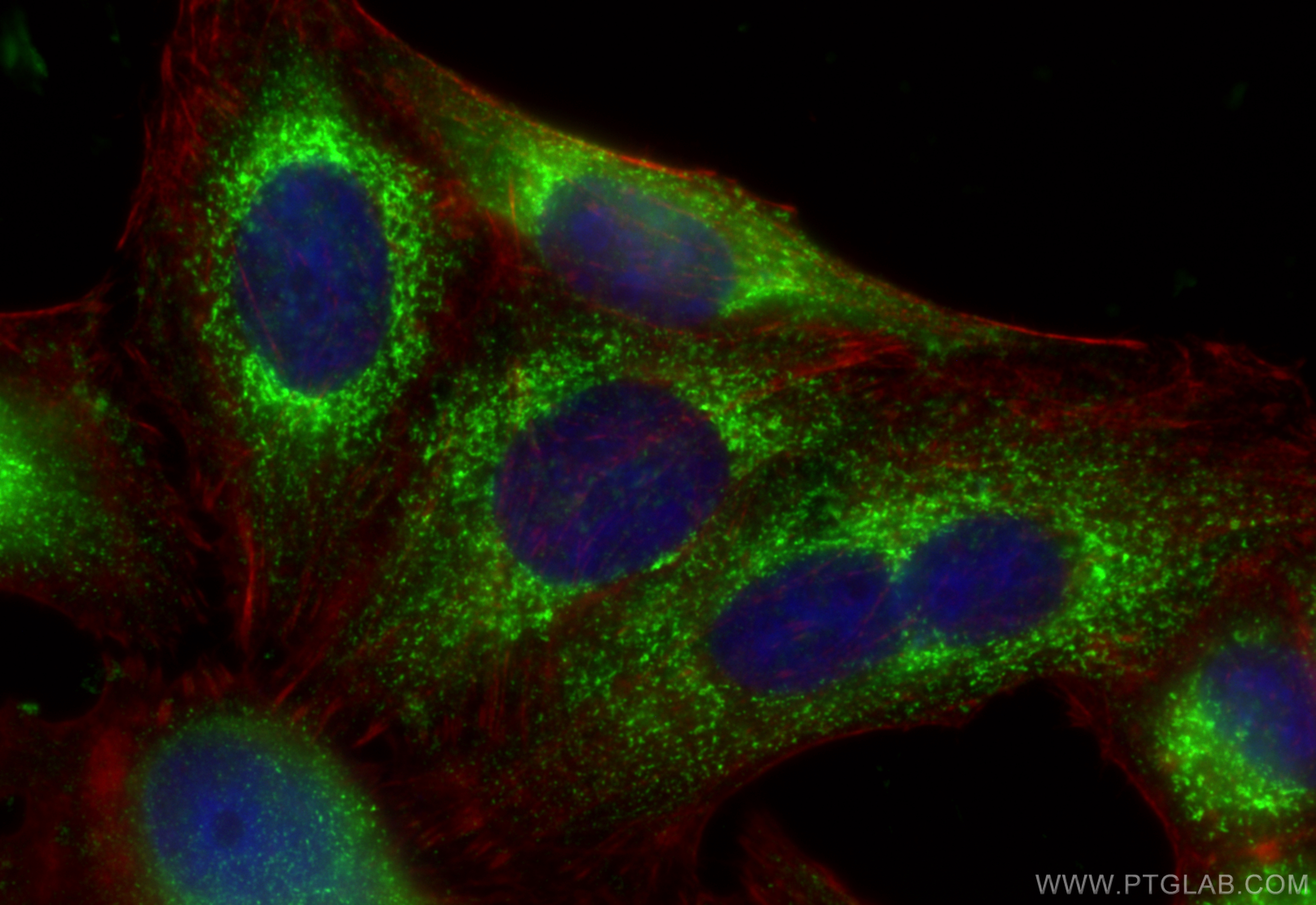 Immunofluorescence (IF) / fluorescent staining of HepG2 cells using CKAP4 Polyclonal antibody (16686-1-AP)