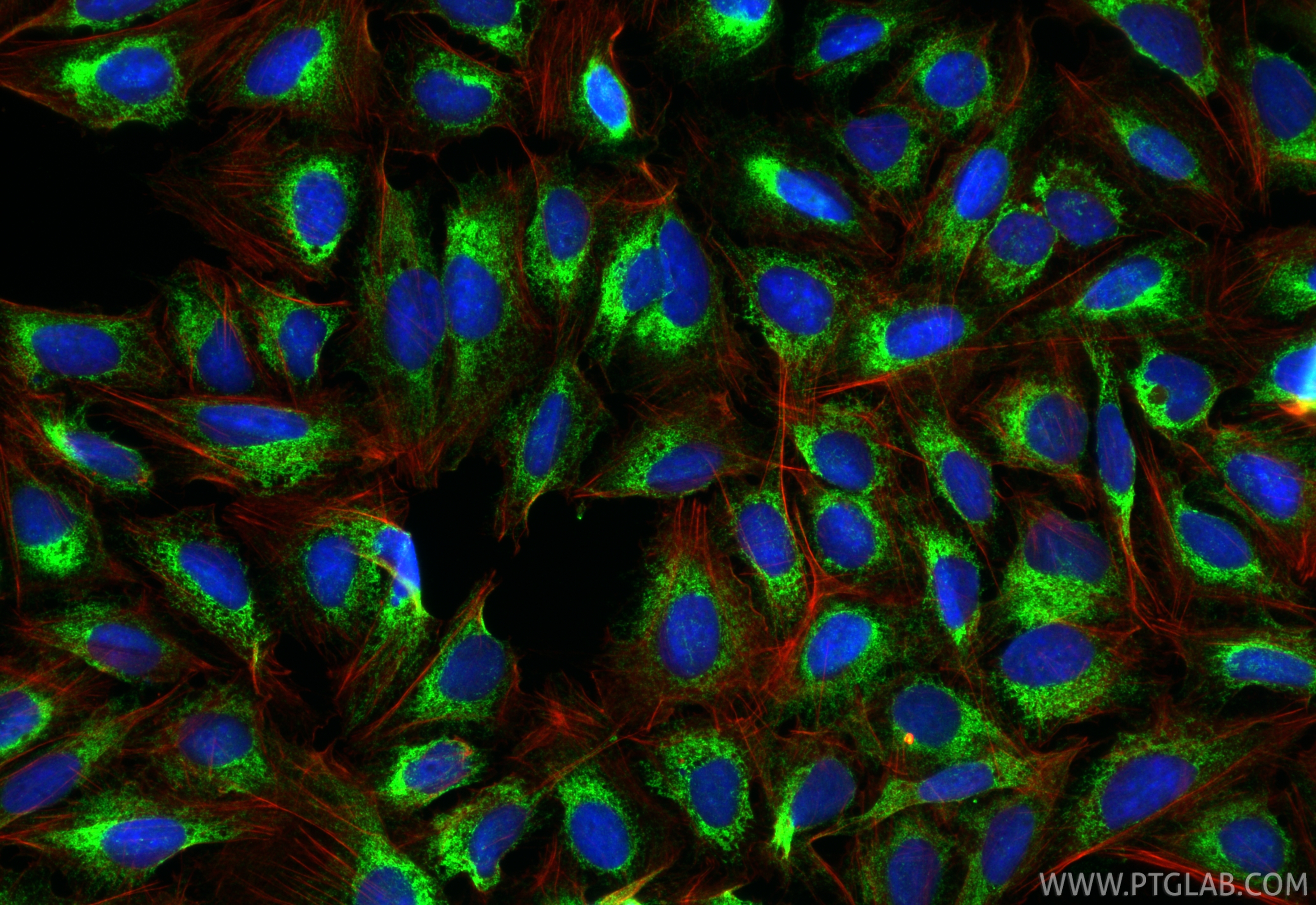 Immunofluorescence (IF) / fluorescent staining of U2OS cells using CKAP4 Polyclonal antibody (16686-1-AP)