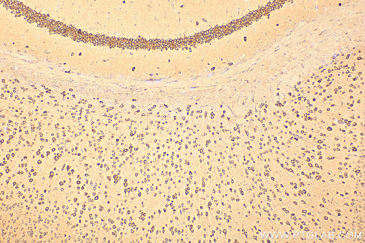 Immunohistochemistry (IHC) staining of mouse brain tissue using CKAP4 Polyclonal antibody (16686-1-AP)