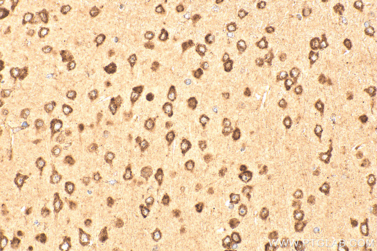 Immunohistochemistry (IHC) staining of mouse brain tissue using CKAP4 Polyclonal antibody (16686-1-AP)