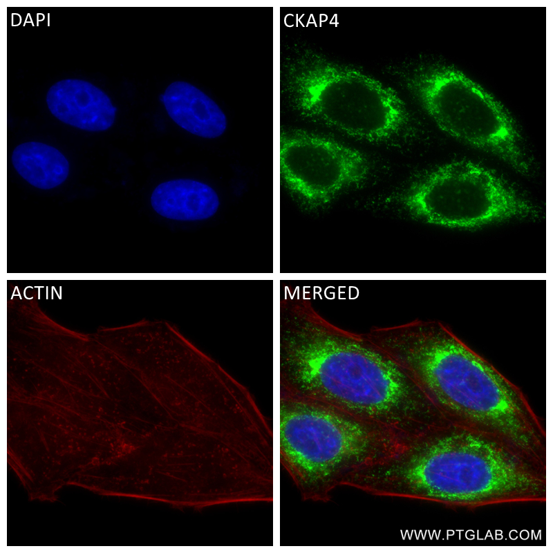 Immunofluorescence (IF) / fluorescent staining of HepG2 cells using CKAP4 Recombinant antibody (84485-4-RR)