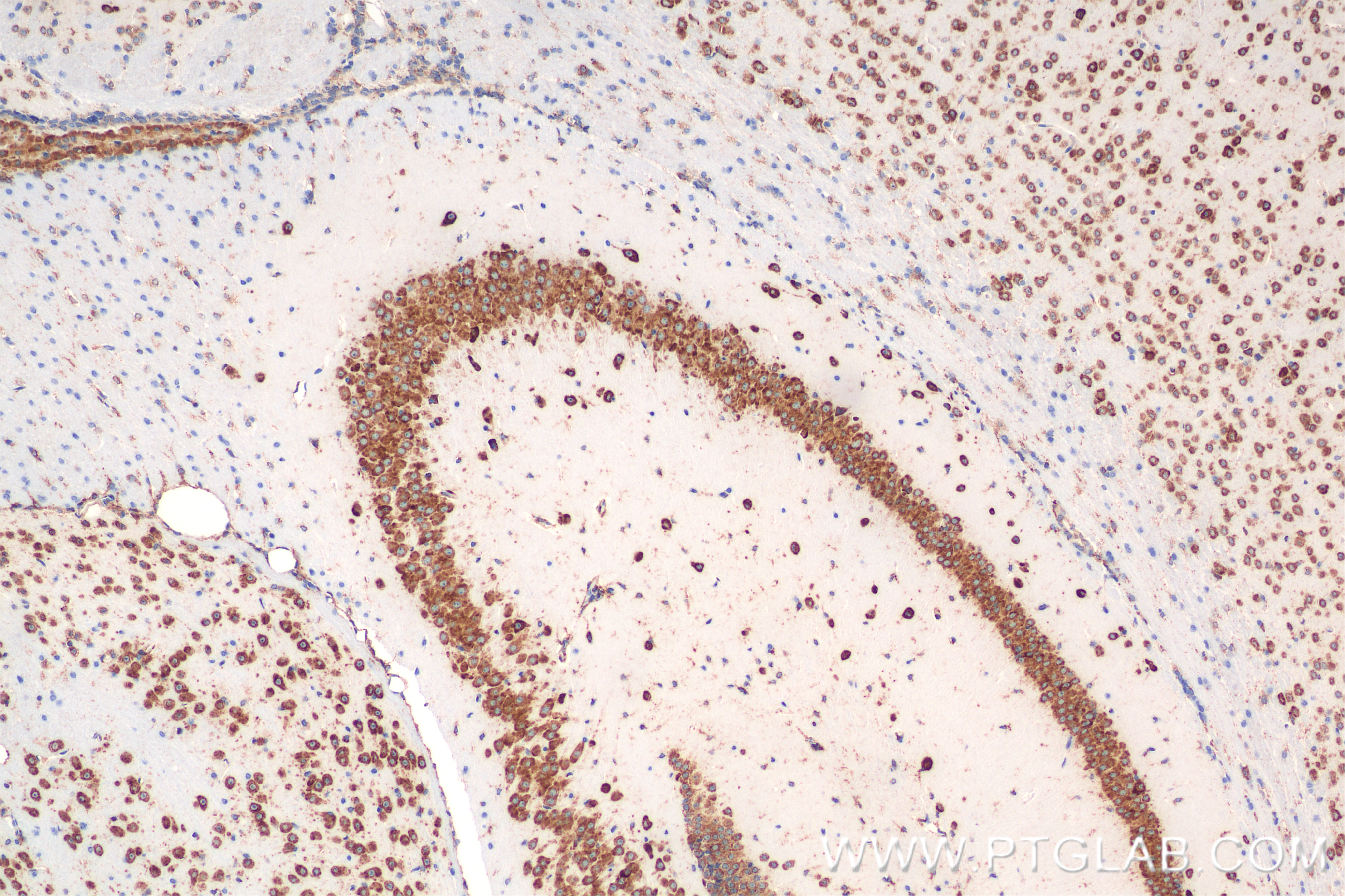 Immunohistochemistry (IHC) staining of mouse brain tissue using CKAP4 Recombinant antibody (84485-5-RR)