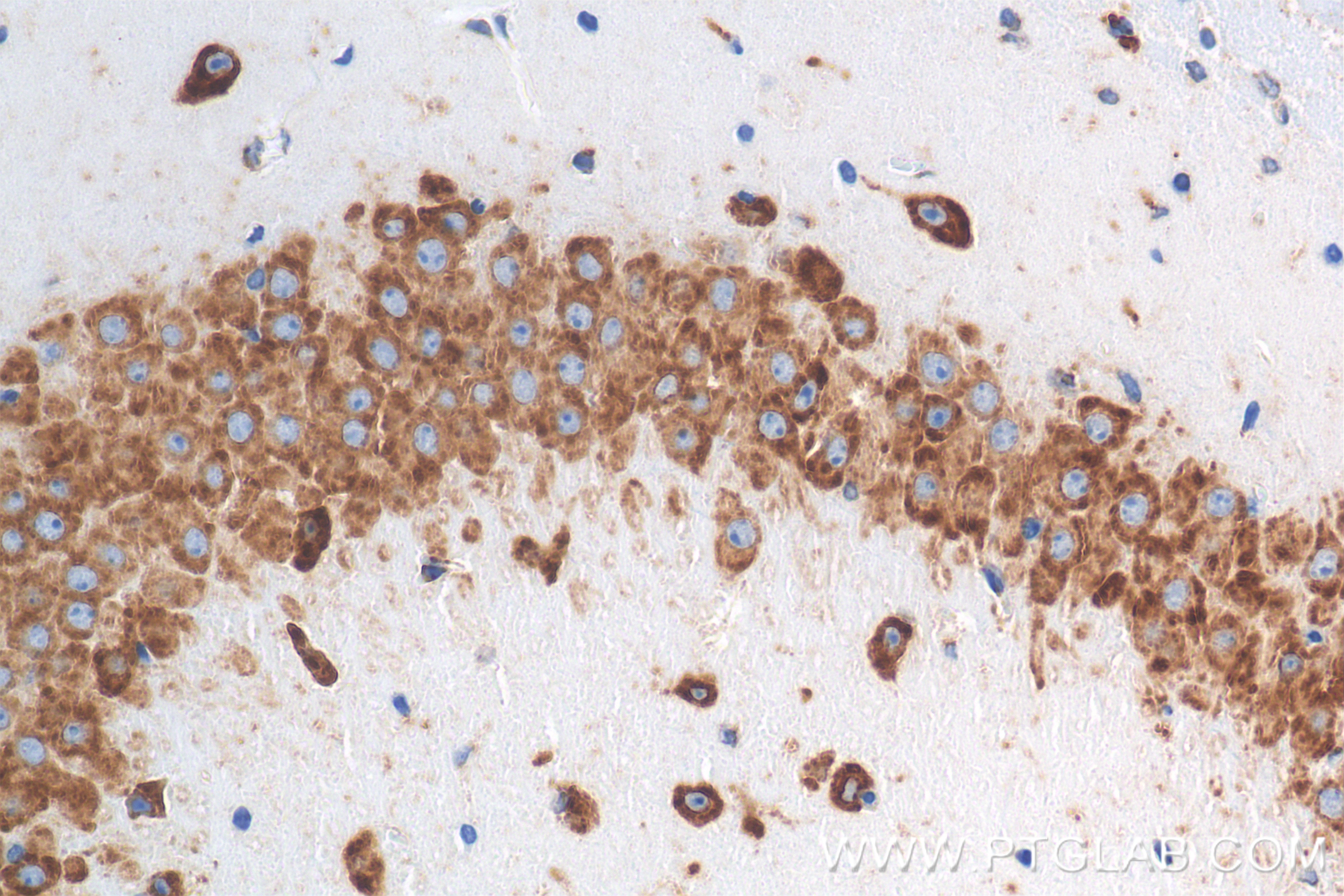Immunohistochemistry (IHC) staining of mouse brain tissue using CKAP4 Recombinant antibody (84485-5-RR)