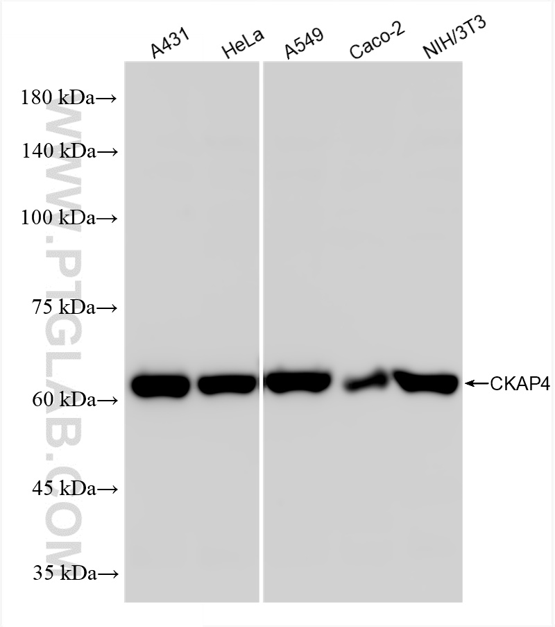 Western Blot (WB) analysis of various lysates using CKAP4 Recombinant antibody (84485-5-RR)