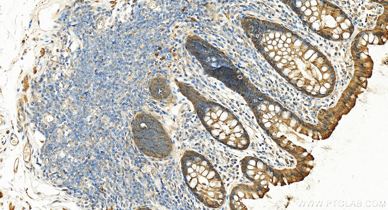 Immunohistochemistry (IHC) staining of human normal colon using CKB-Specific Polyclonal antibody (18713-1-AP)