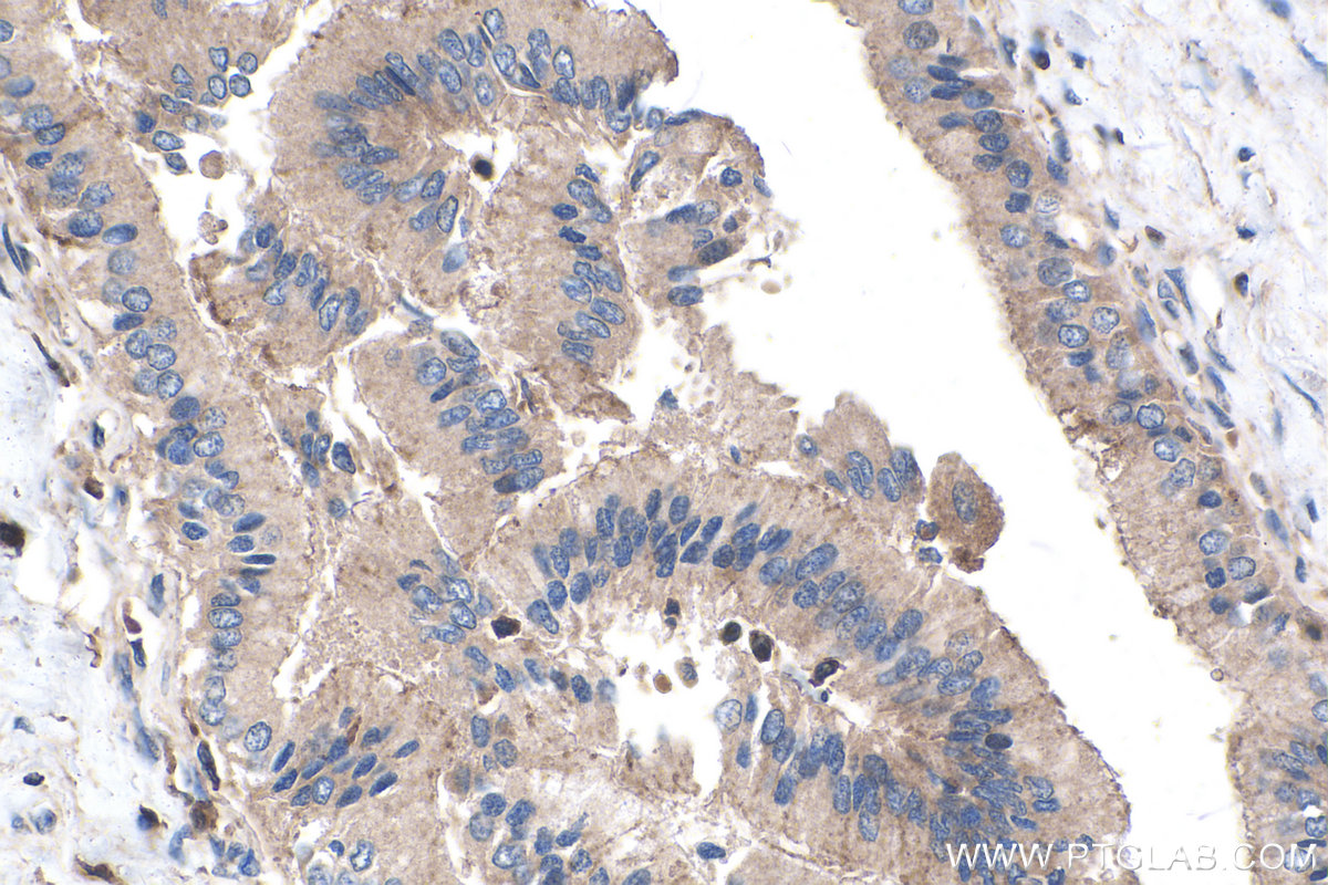 Immunohistochemistry (IHC) staining of human liver tissue using CKM-Specific Monoclonal antibody (60177-1-Ig)