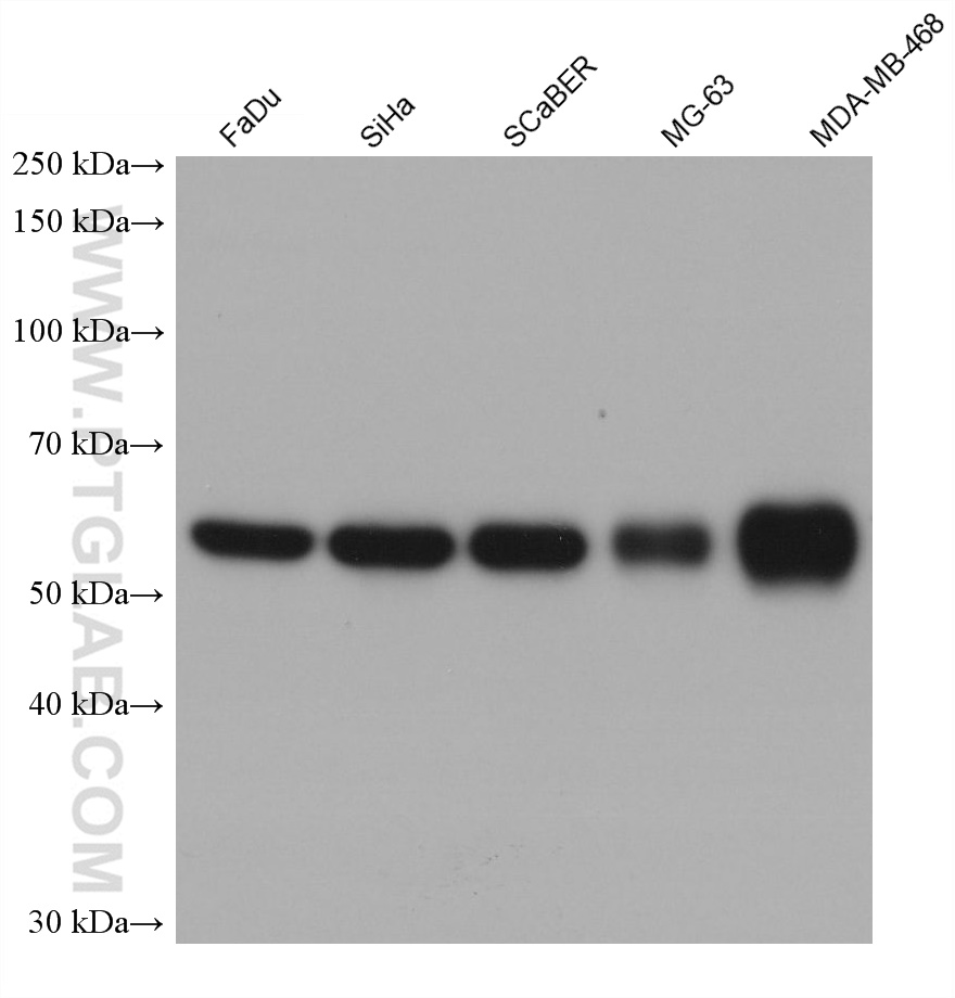 Western Blot (WB) analysis of various lysates using CLCC1 Monoclonal antibody (68853-7-Ig)