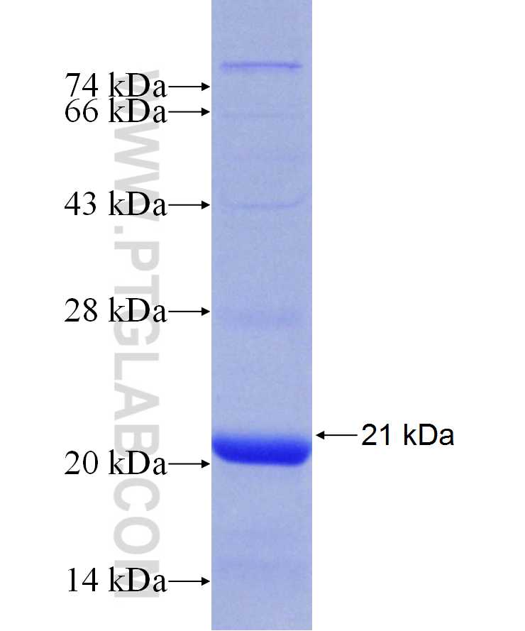 CLCN7 fusion protein Ag29882 SDS-PAGE