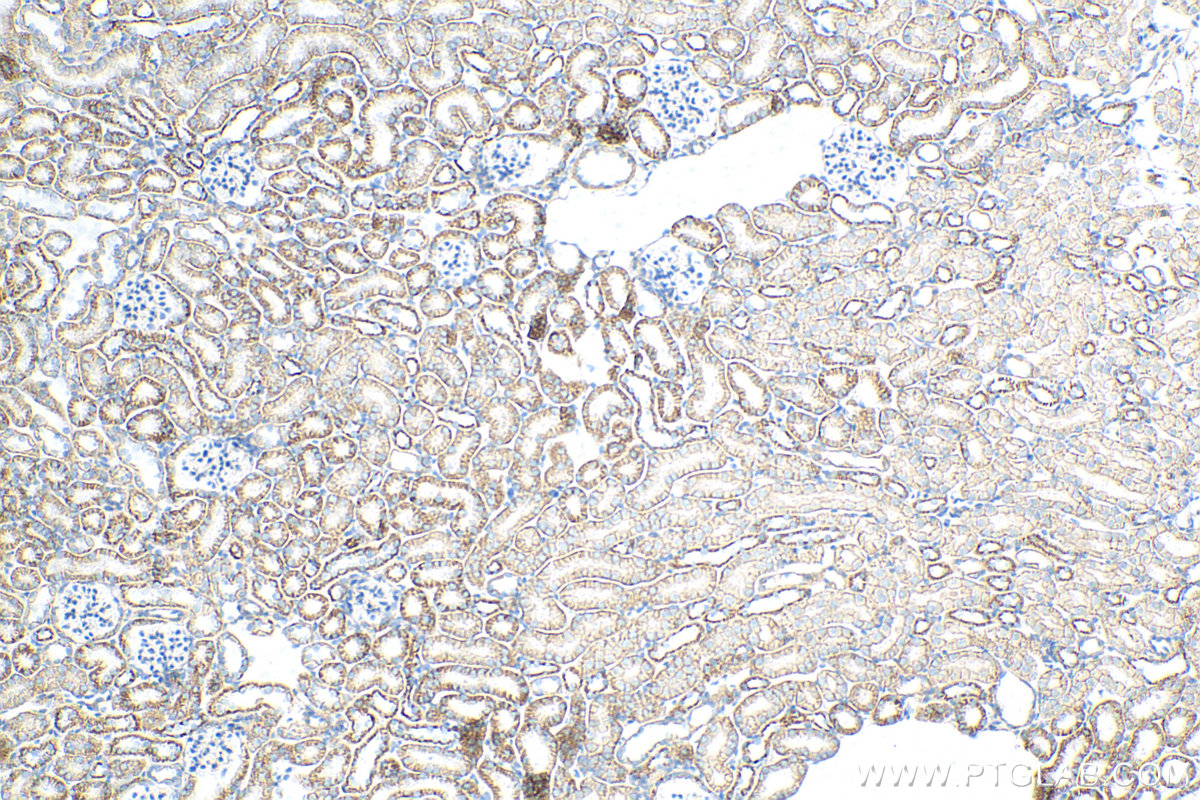 Immunohistochemistry (IHC) staining of mouse kidney tissue using CLDN16 Recombinant antibody (82954-1-RR)