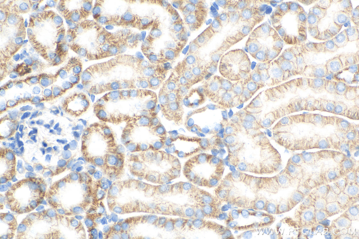 Immunohistochemistry (IHC) staining of mouse kidney tissue using CLDN16 Recombinant antibody (82954-1-RR)