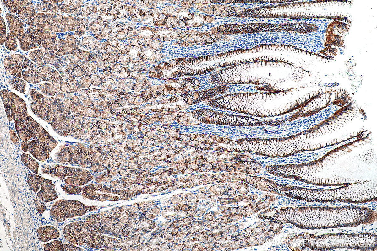 Immunohistochemistry (IHC) staining of human stomach tissue using Claudin 18 Polyclonal antibody (21126-1-AP)