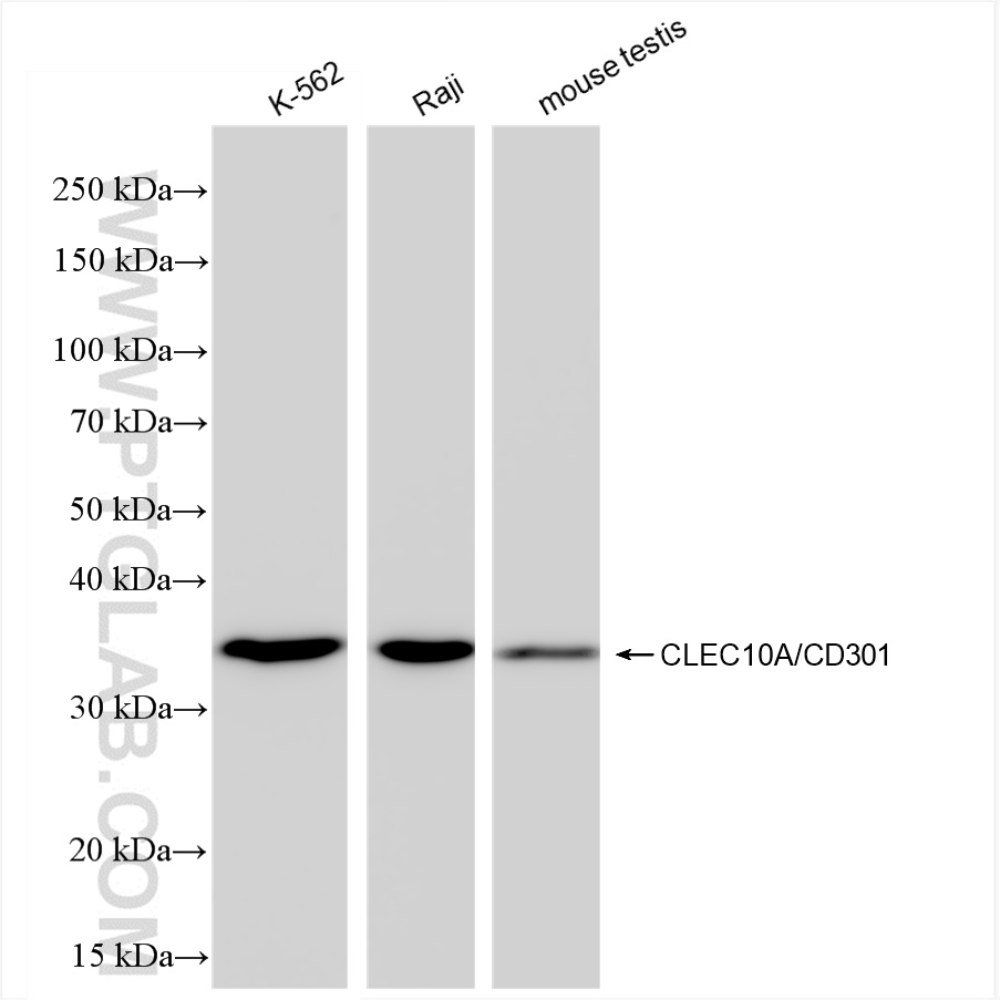 CLEC10A