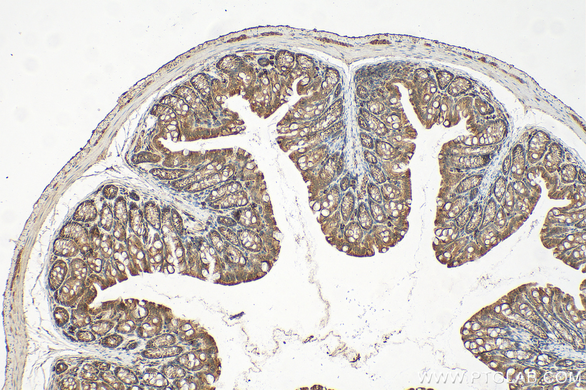 Immunohistochemistry (IHC) staining of mouse colon tissue using CLIC1 Polyclonal antibody (14545-1-AP)