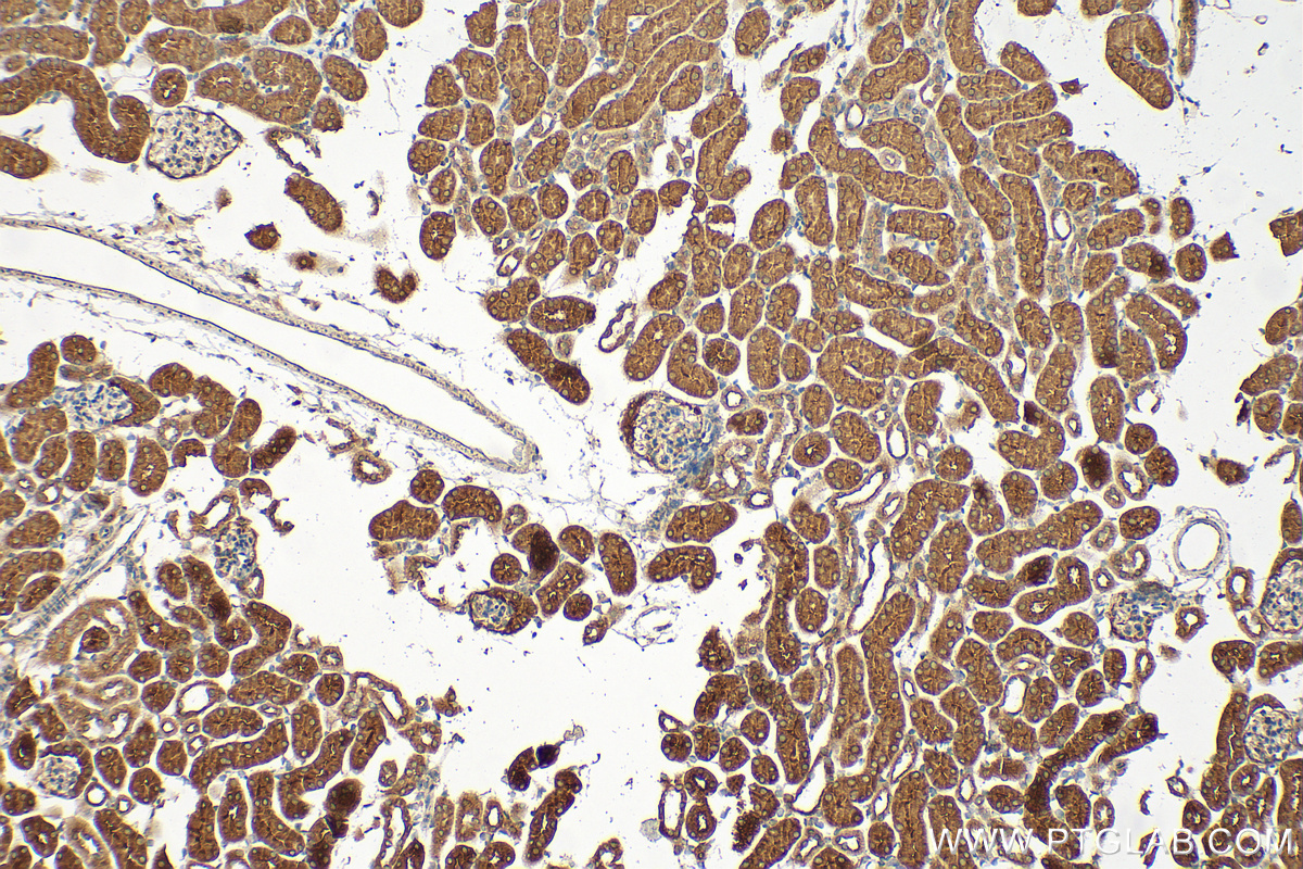 Immunohistochemistry (IHC) staining of mouse kidney tissue using CLIC1 Polyclonal antibody (14545-1-AP)