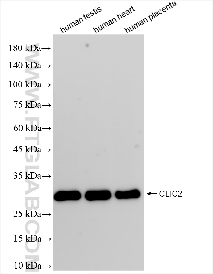 Western Blot (WB) analysis of various lysates using CLIC2 Recombinant antibody (83730-3-RR)