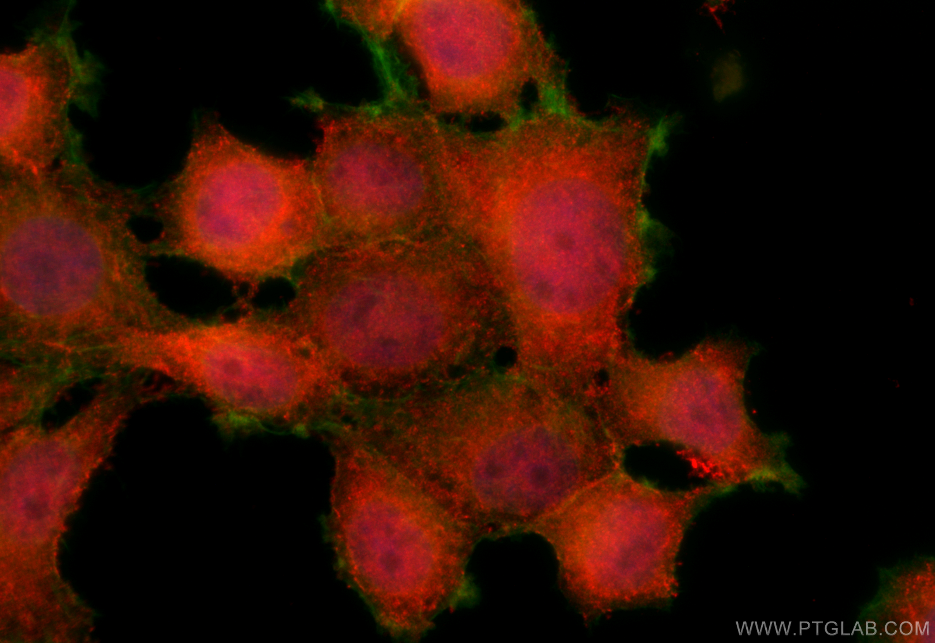 Immunofluorescence (IF) / fluorescent staining of MCF-7 cells using CLIC3 Polyclonal antibody (15971-1-AP)