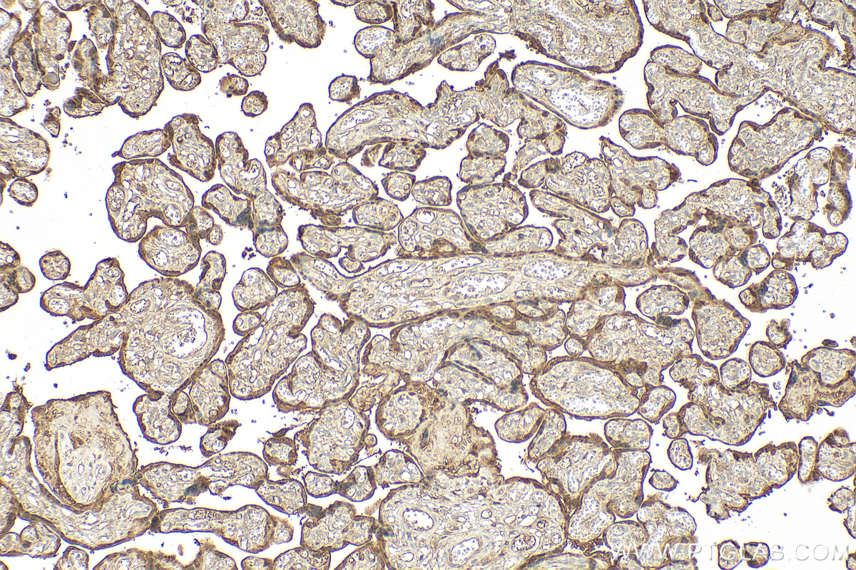 Immunohistochemistry (IHC) staining of human placenta tissue using CLIC3 Polyclonal antibody (15971-1-AP)