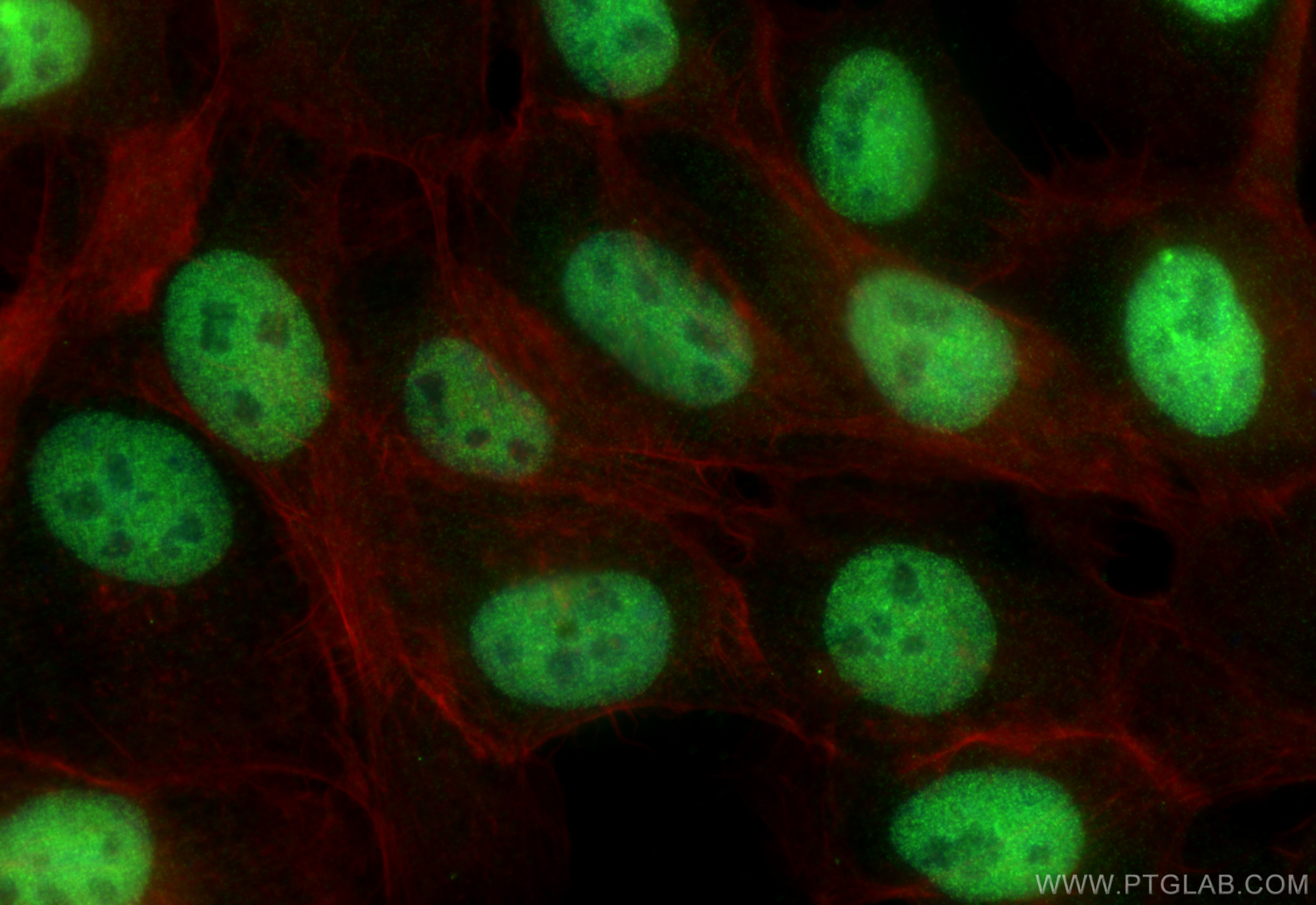 Immunofluorescence (IF) / fluorescent staining of A431 cells using CLIC3 Recombinant antibody (84759-4-RR)