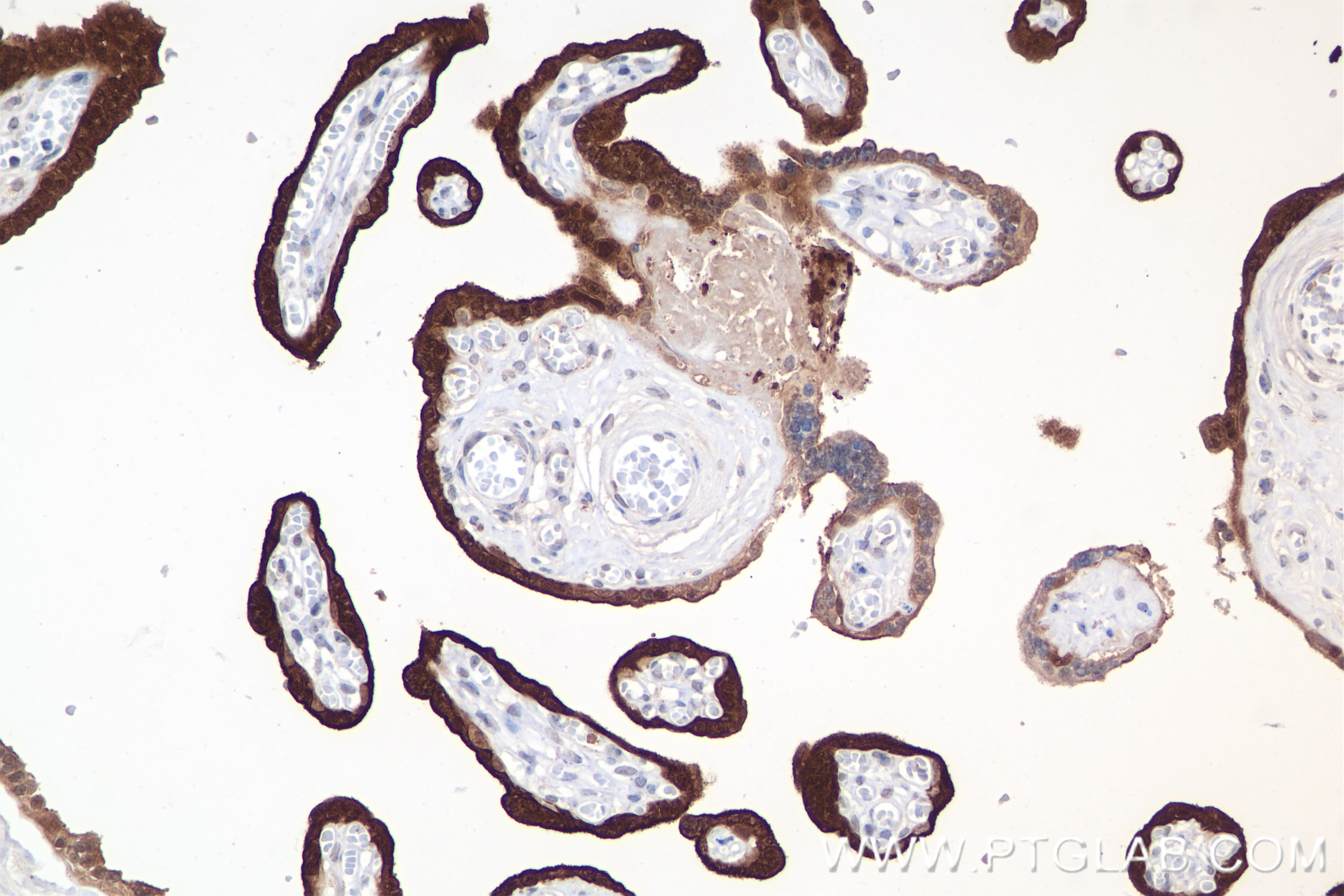 Immunohistochemistry (IHC) staining of human placenta tissue using CLIC3 Recombinant antibody (84759-4-RR)