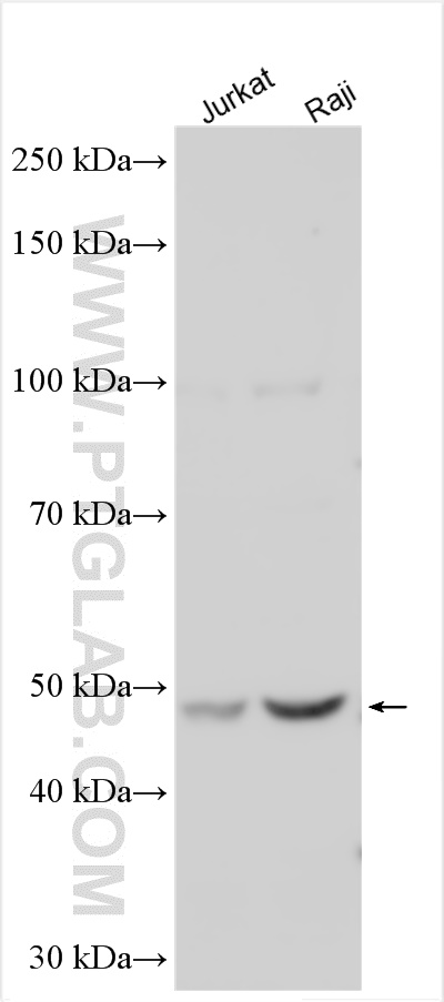 Western Blot (WB) analysis of various lysates using CLN3 Polyclonal antibody (20386-1-AP)