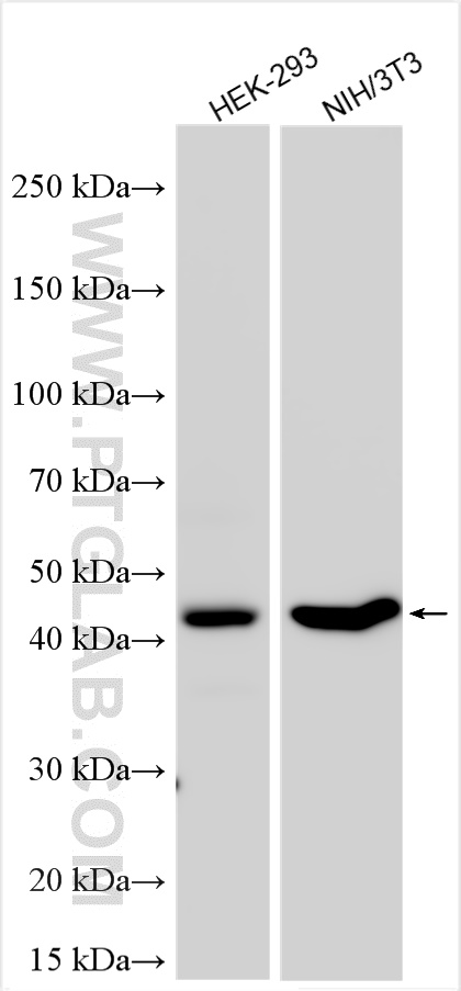 Western Blot (WB) analysis of various lysates using CLN5 Polyclonal antibody (24605-1-AP)