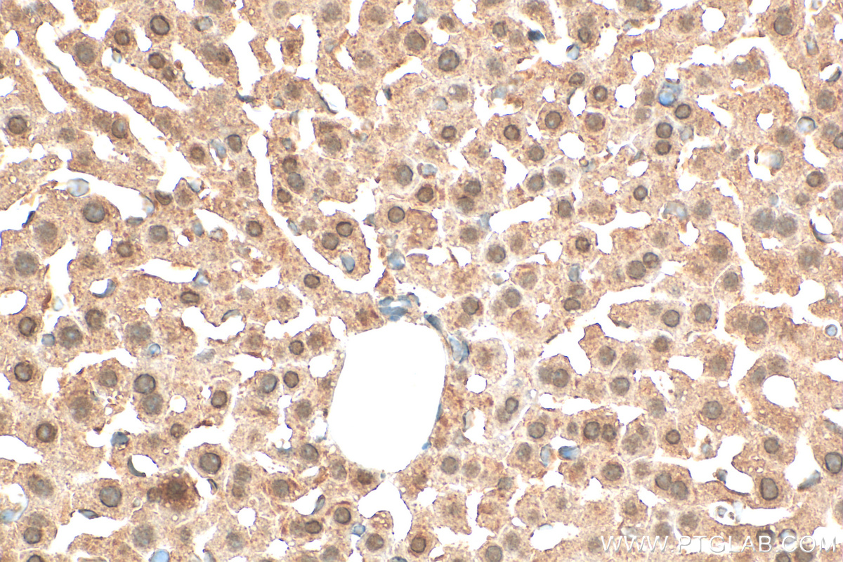 Immunohistochemistry (IHC) staining of mouse liver tissue using CLOCK Polyclonal antibody (30680-1-AP)