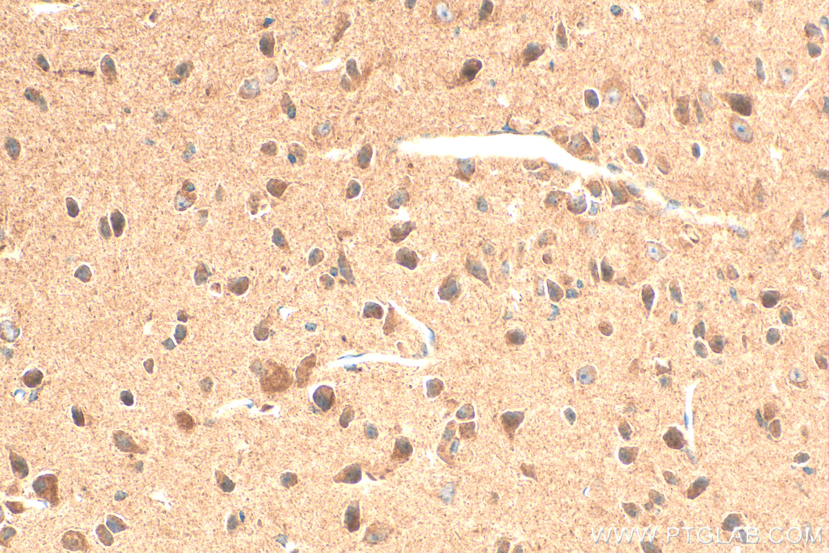 Immunohistochemistry (IHC) staining of mouse brain tissue using CLPTM1 Polyclonal antibody (15337-1-AP)