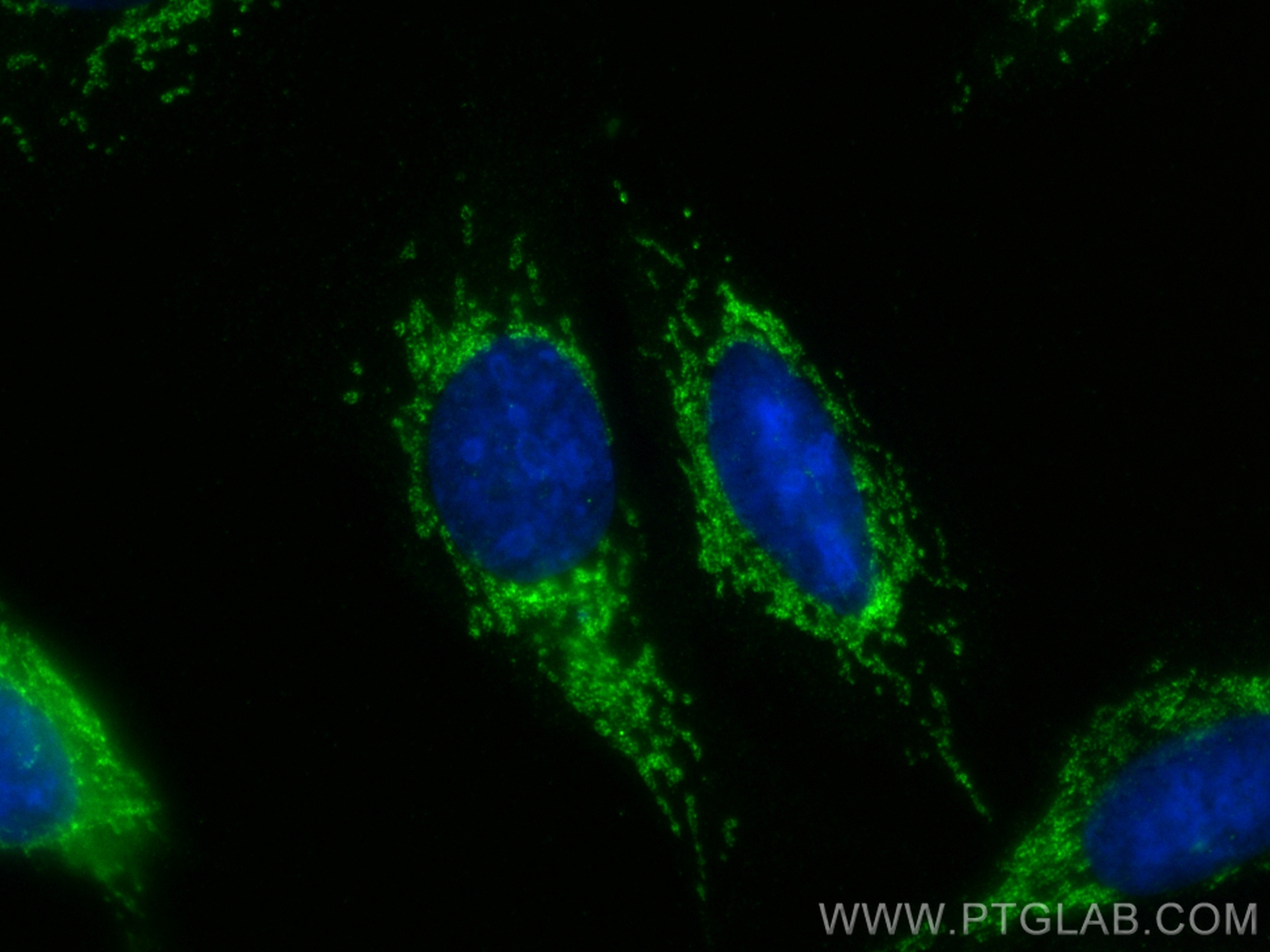 Immunofluorescence (IF) / fluorescent staining of U2OS cells using CLPX Recombinant monoclonal antibody (83097-1-RR)