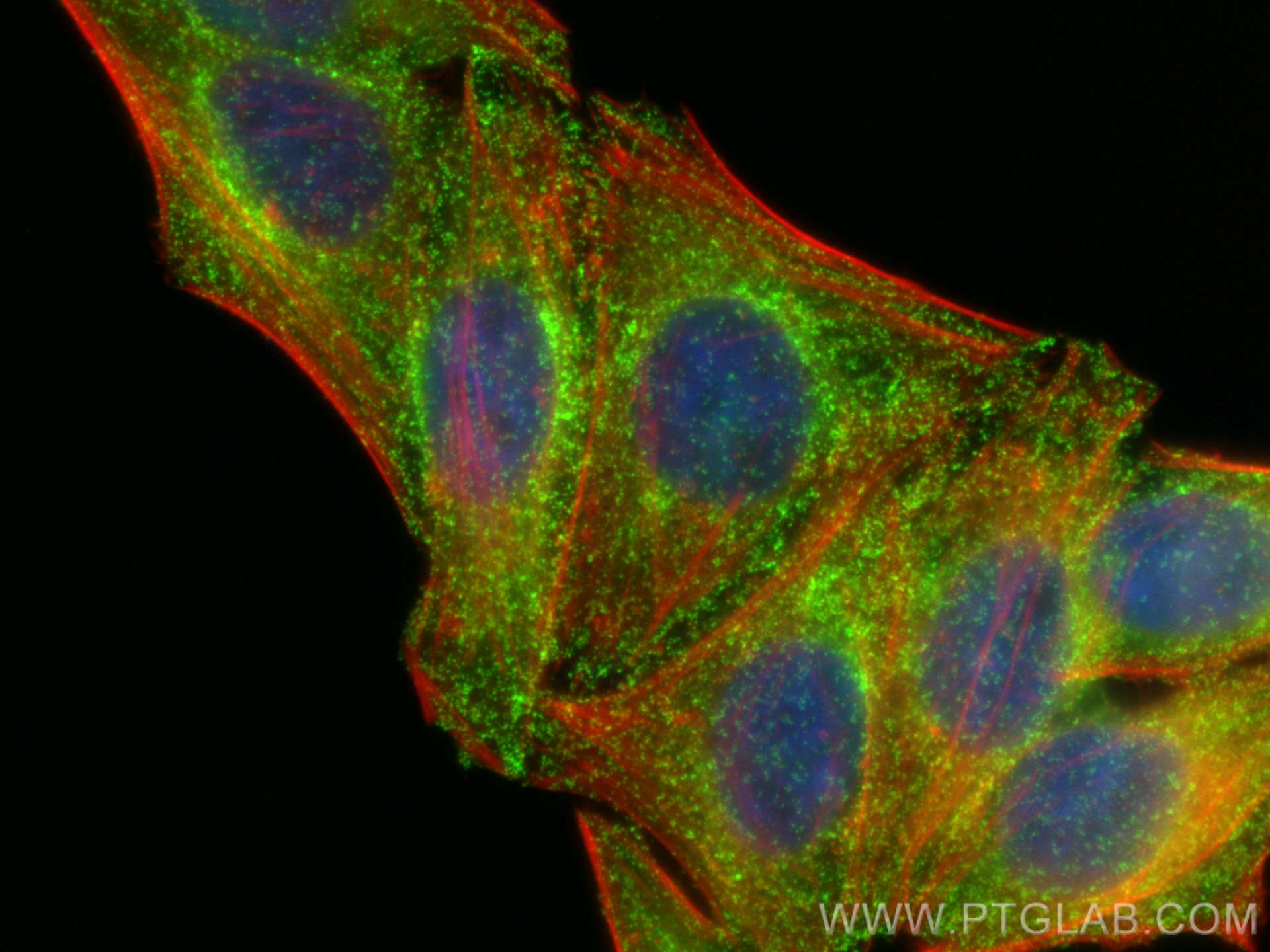 Immunofluorescence (IF) / fluorescent staining of HepG2 cells using CLTA Polyclonal antibody (10852-1-AP)