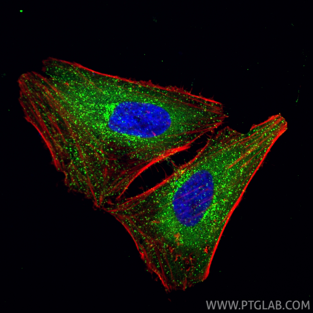 Immunofluorescence (IF) / fluorescent staining of HeLa cells using CLTA Polyclonal antibody (10852-1-AP)