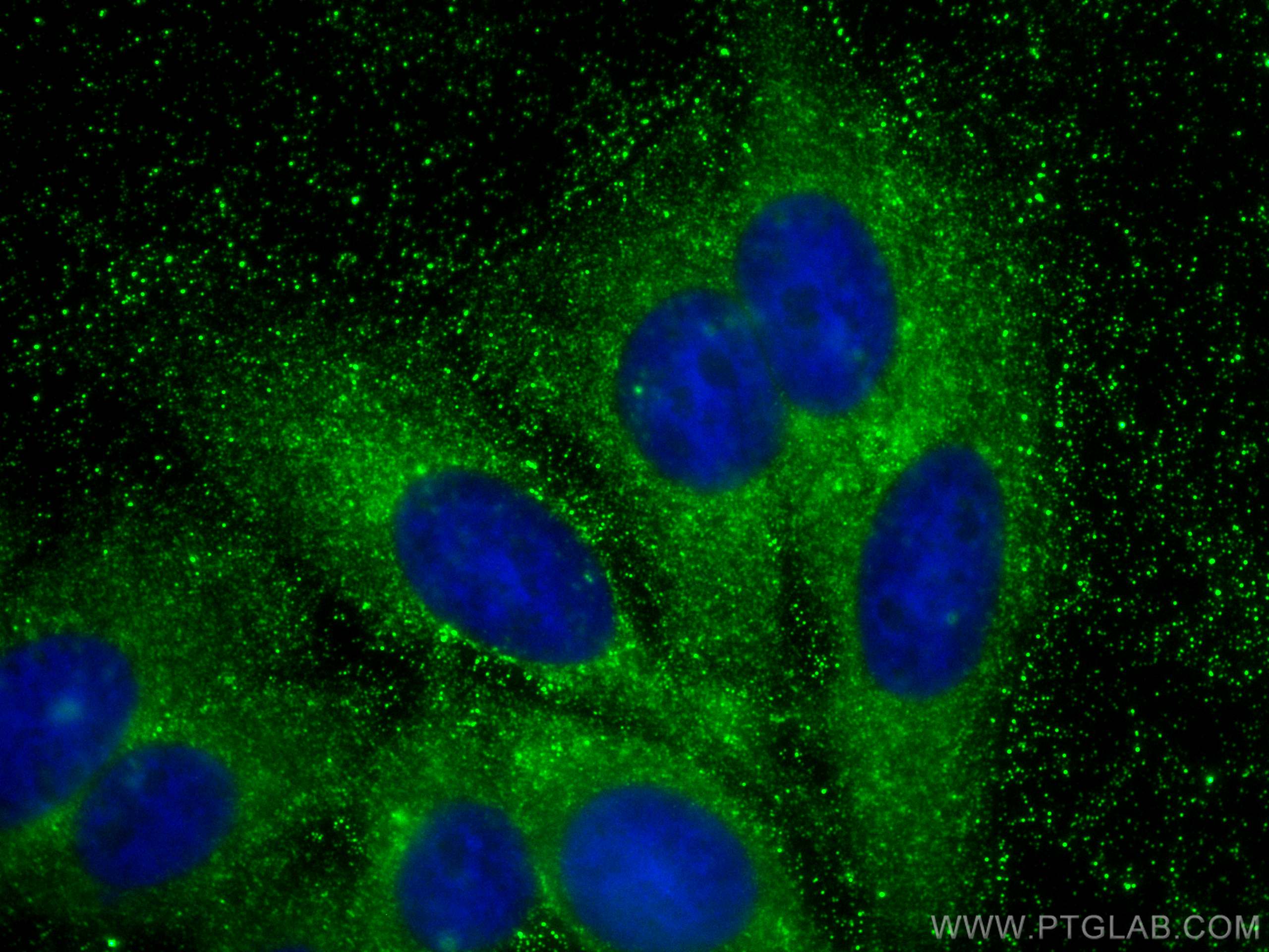 Immunofluorescence (IF) / fluorescent staining of HepG2 cells using CLTC Monoclonal antibody (66487-1-Ig)
