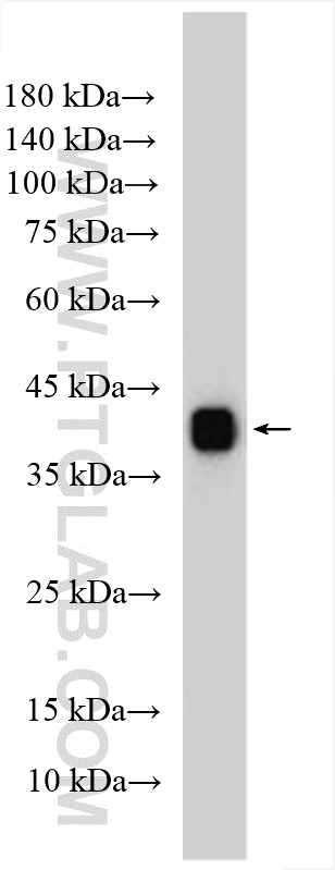 Western Blot (WB) analysis of human plasma using Clusterin Polyclonal antibody (12289-1-AP)