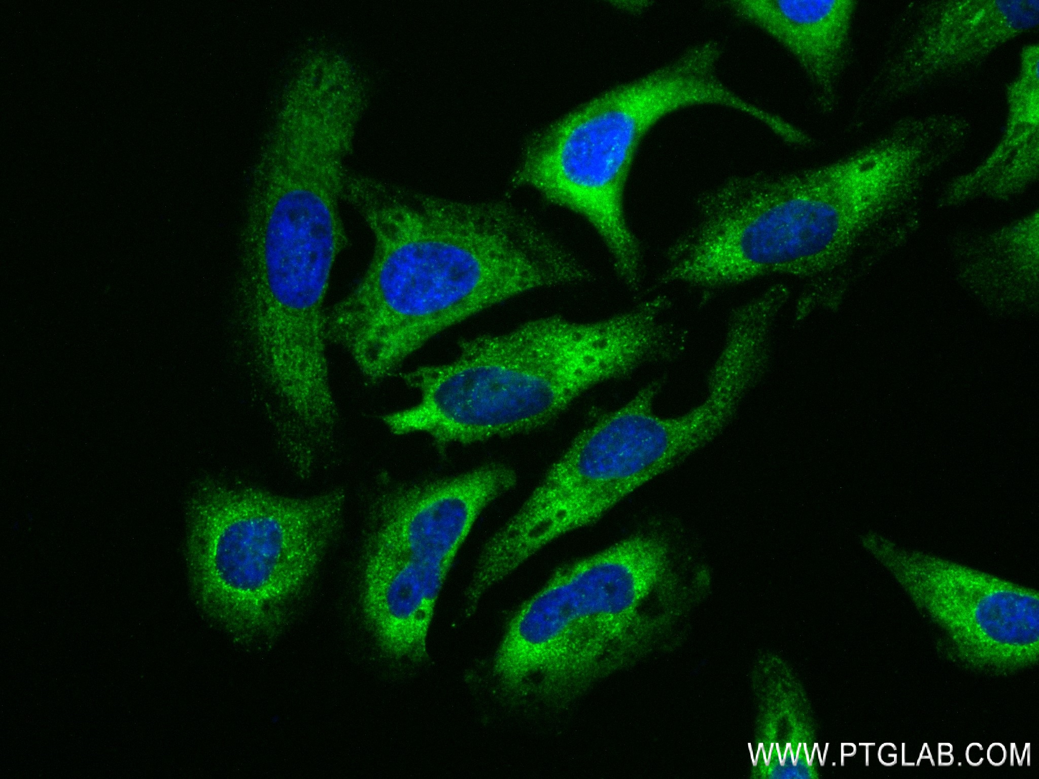 Immunofluorescence (IF) / fluorescent staining of HeLa cells using CLUH Recombinant antibody (84321-4-RR)