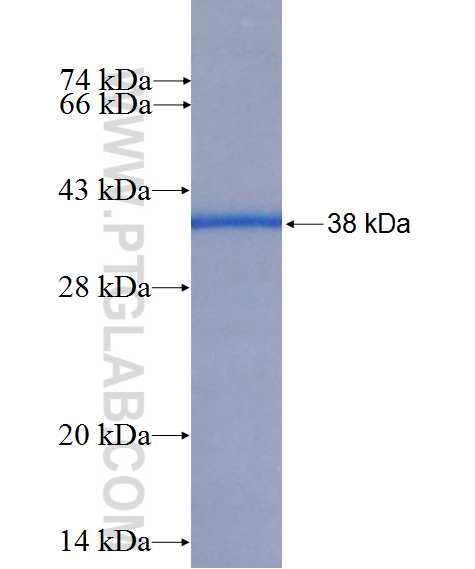 CLUL1 fusion protein Ag26570 SDS-PAGE