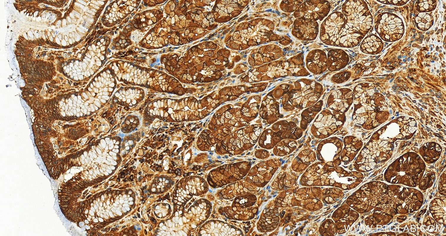 Immunohistochemistry (IHC) staining of human stomach tissue using CMIP Polyclonal antibody (12851-1-AP)