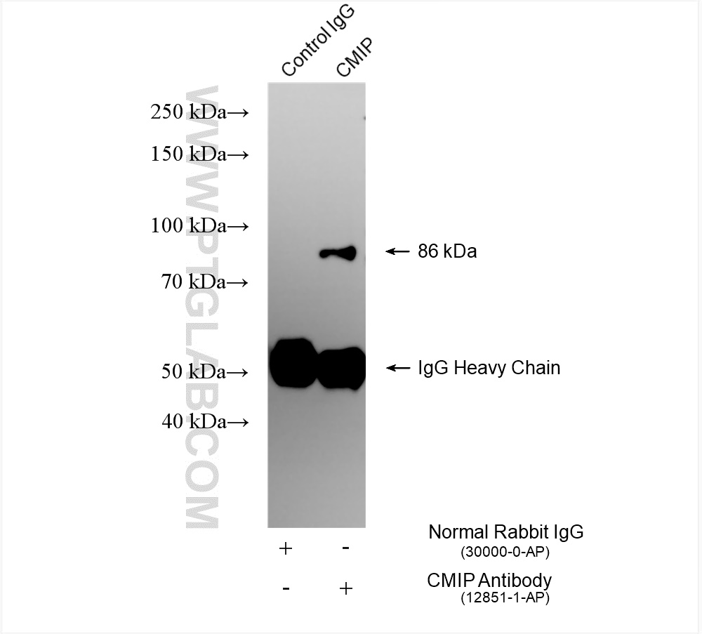 Immunoprecipitation (IP) experiment of Raji cells using CMIP Polyclonal antibody (12851-1-AP)