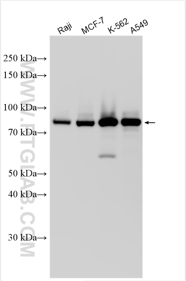 Western Blot (WB) analysis of various lysates using CMIP Polyclonal antibody (31407-1-AP)