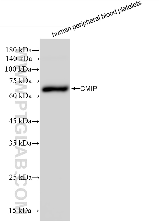 Western Blot (WB) analysis of human peripheral blood platelets using CMIP Recombinant antibody (83381-1-RR)