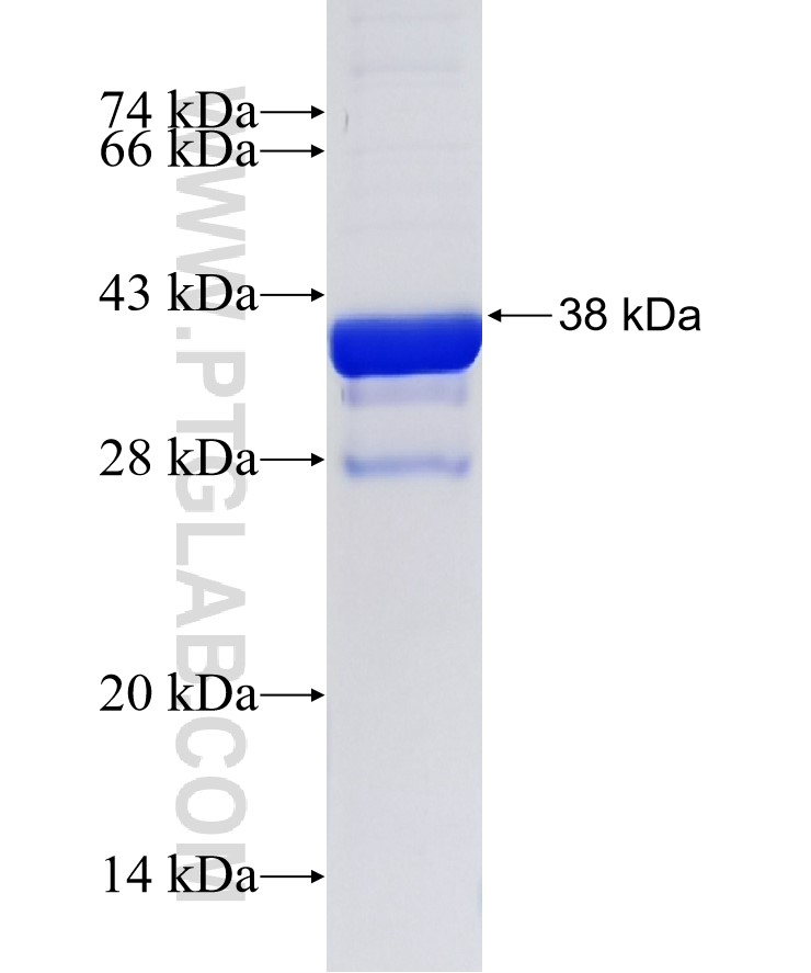 CMIP fusion protein Ag35679 SDS-PAGE