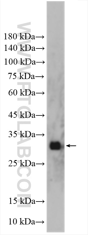 Western Blot (WB) analysis of mouse bladder tissue using CMTM8 Polyclonal antibody (15039-1-AP)
