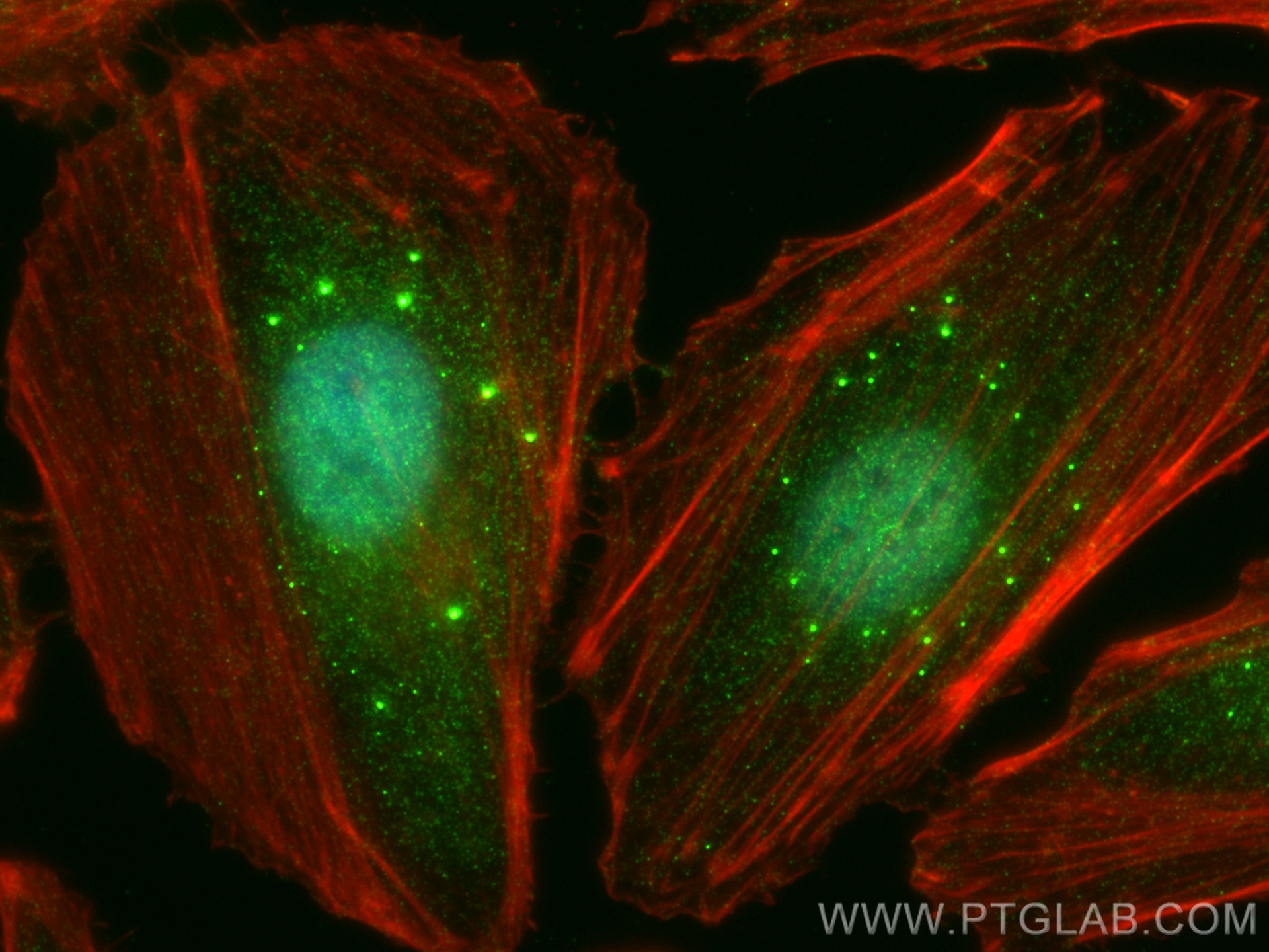 Immunofluorescence (IF) / fluorescent staining of HeLa cells using CNBP Polyclonal antibody (12103-1-AP)