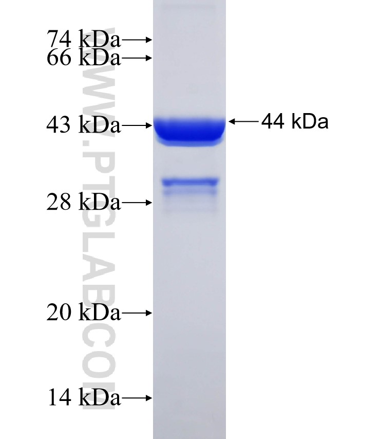 CNDP2 fusion protein Ag32312 SDS-PAGE