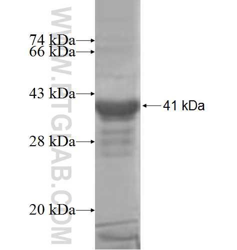 CNDP2 fusion protein Ag7017 SDS-PAGE