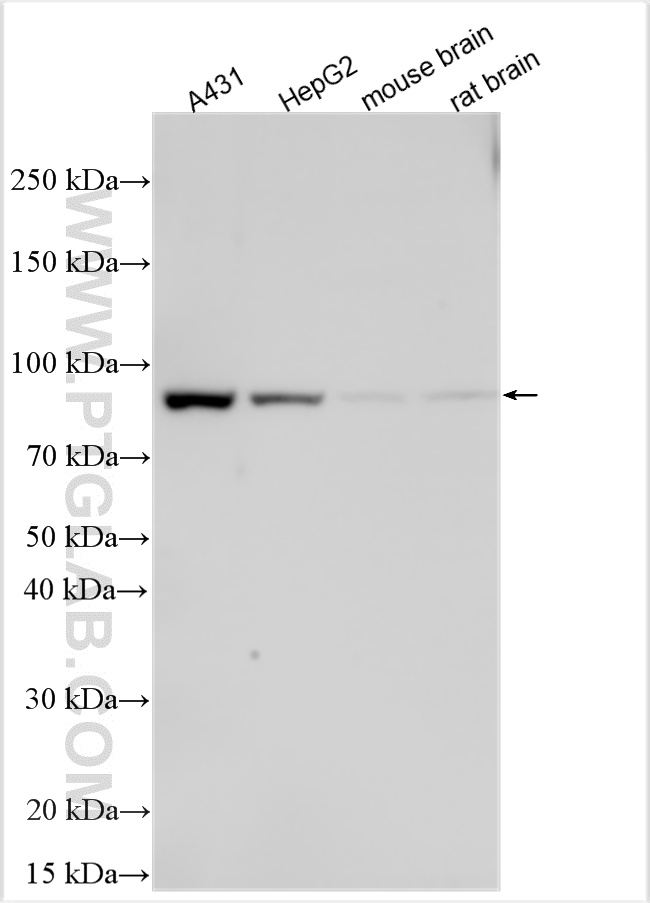 Western Blot (WB) analysis of various lysates using CNGA2 Polyclonal antibody (23823-1-AP)