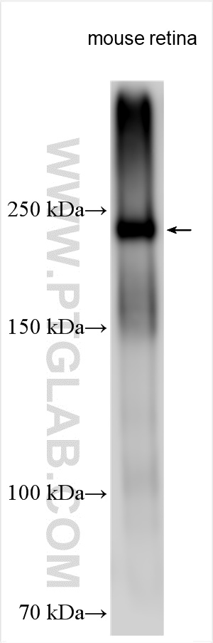 Western Blot (WB) analysis of various lysates using CNGB1 Polyclonal antibody (30557-1-AP)